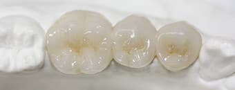 ハイブリッドセラミックス