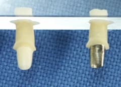 Fポストコアシステム（ペントロン/アメリカ）